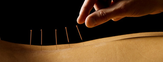 Traditionelle Chinesische Medizin Potsdam